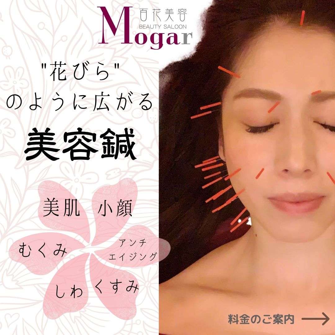 美容鍼 トライアルメニューのご案内